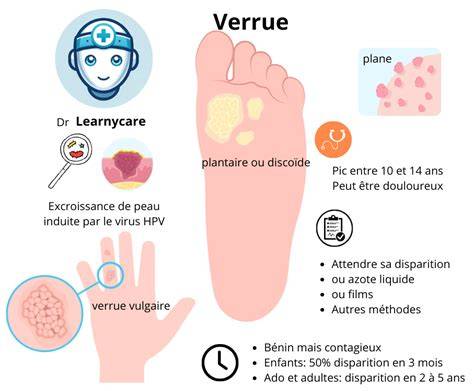 schéma progression verrue vivante morte